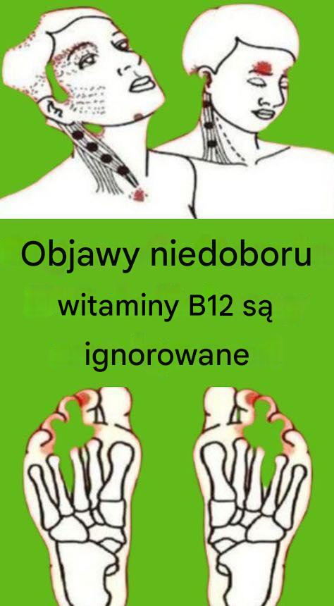 Objawy niedoboru witaminy B12 są ignorowane