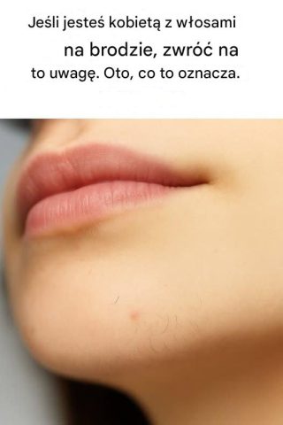 Dlaczego kobiety mają wąsy na brodzie (i co możesz z nimi zrobić)