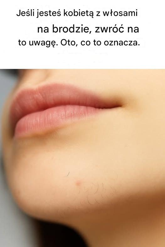 Dlaczego kobiety mają wąsy na brodzie (i co możesz z nimi zrobić)