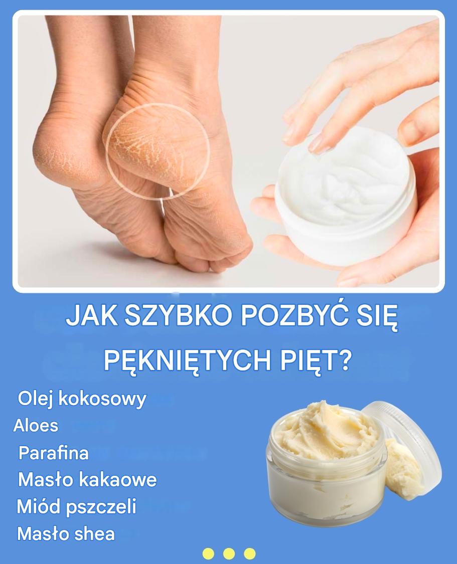 Porady dermatologa: Jak szybko pozbyć się popękanych pięt?