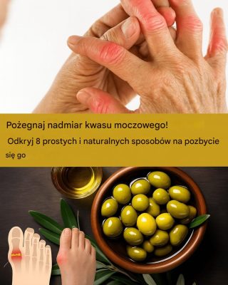 Pożegnaj kwas moczowy w prosty sposób! 8 naturalnych trików, które naprawdę działają (i pokochasz je)